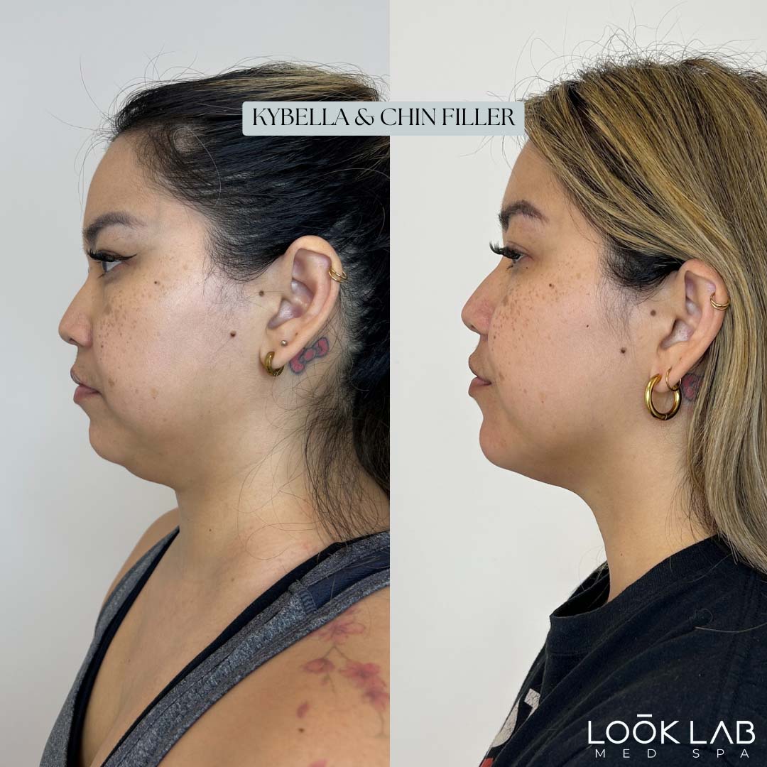Before and After 29