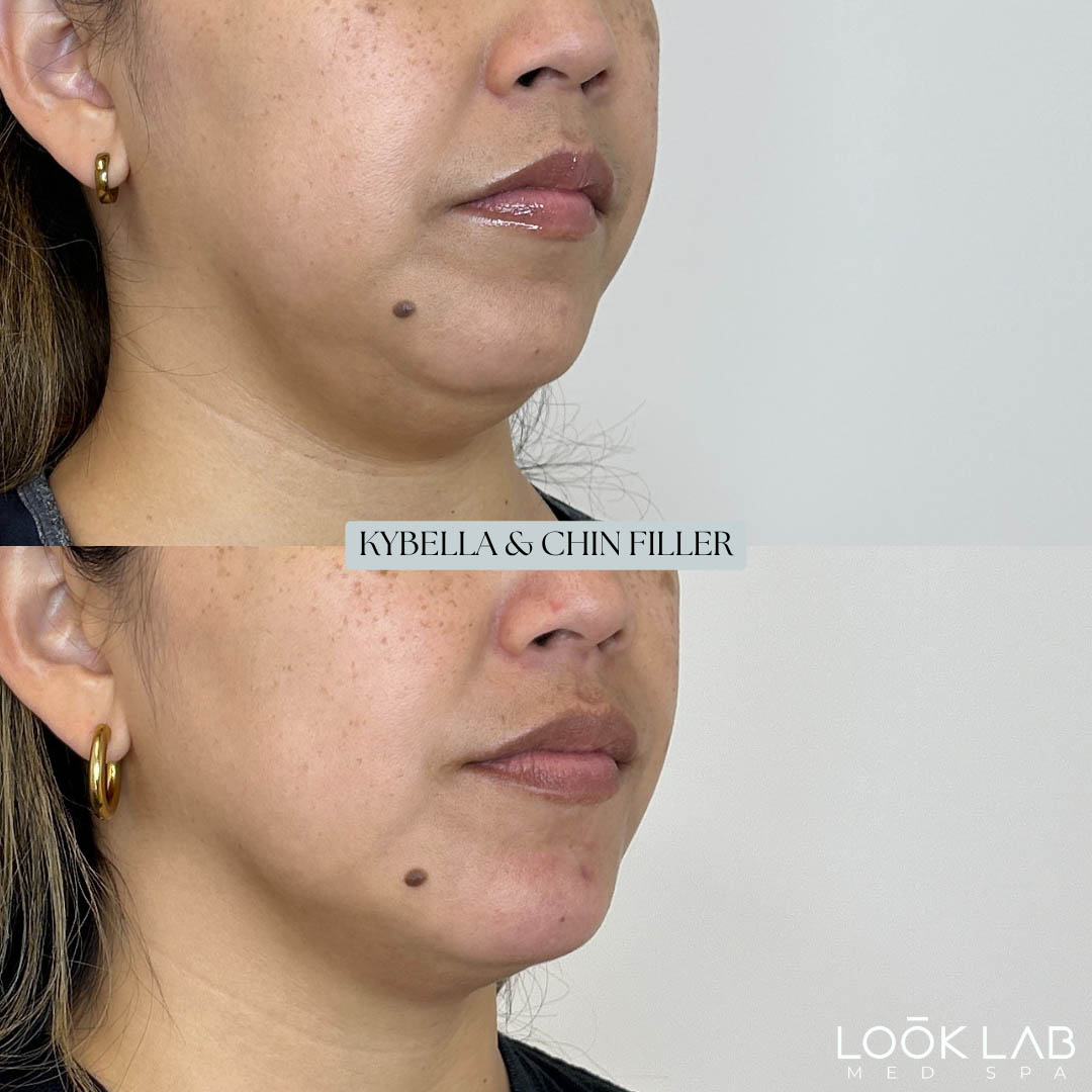 Before and After 31