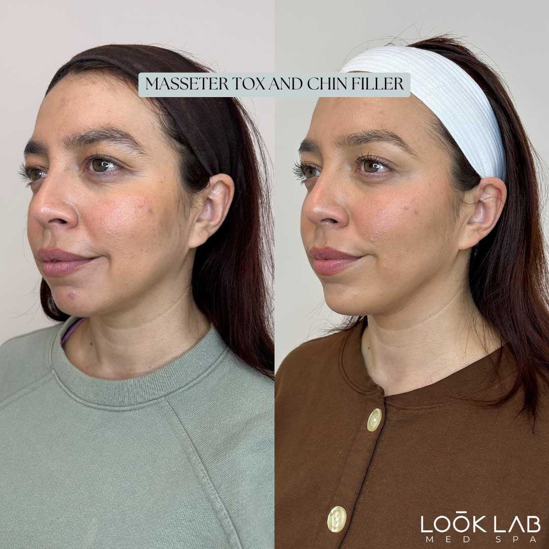 Before and After 33