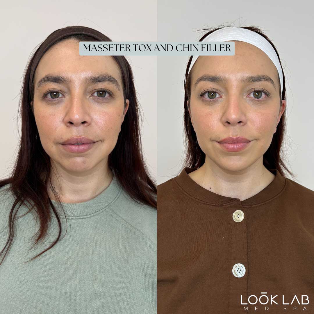Before and After 34