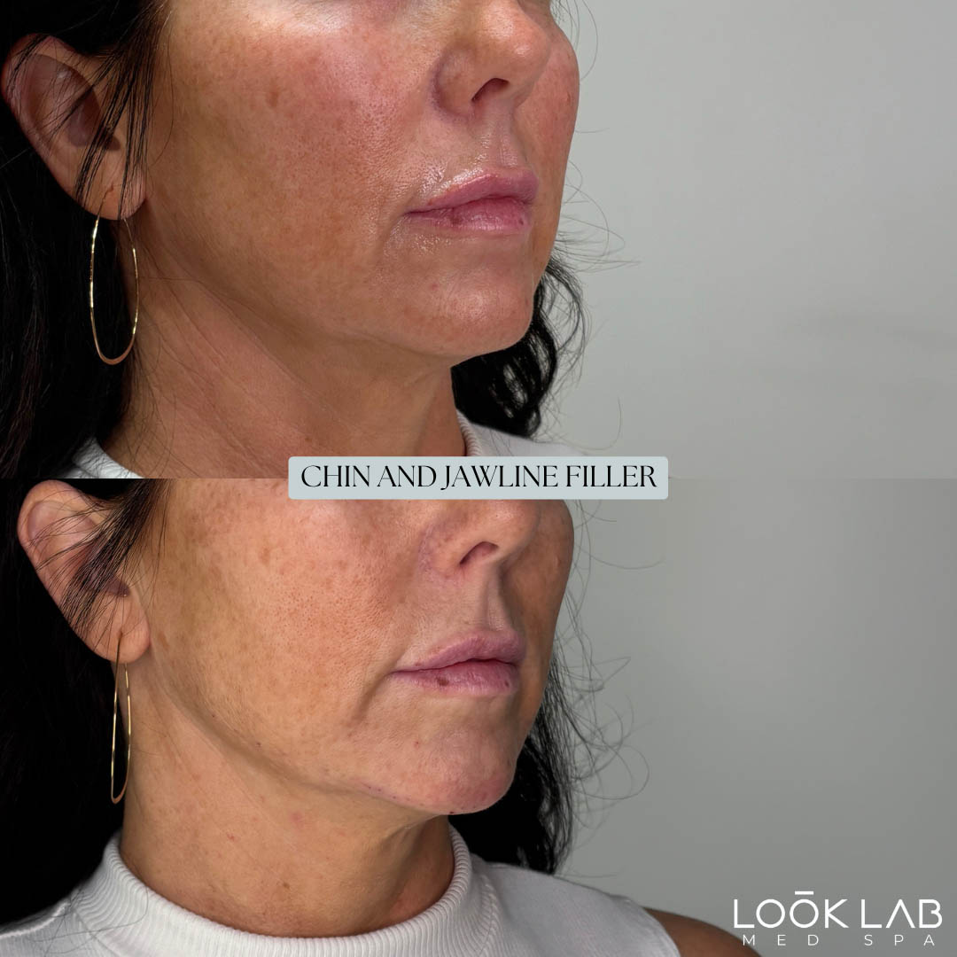 Before and After 35