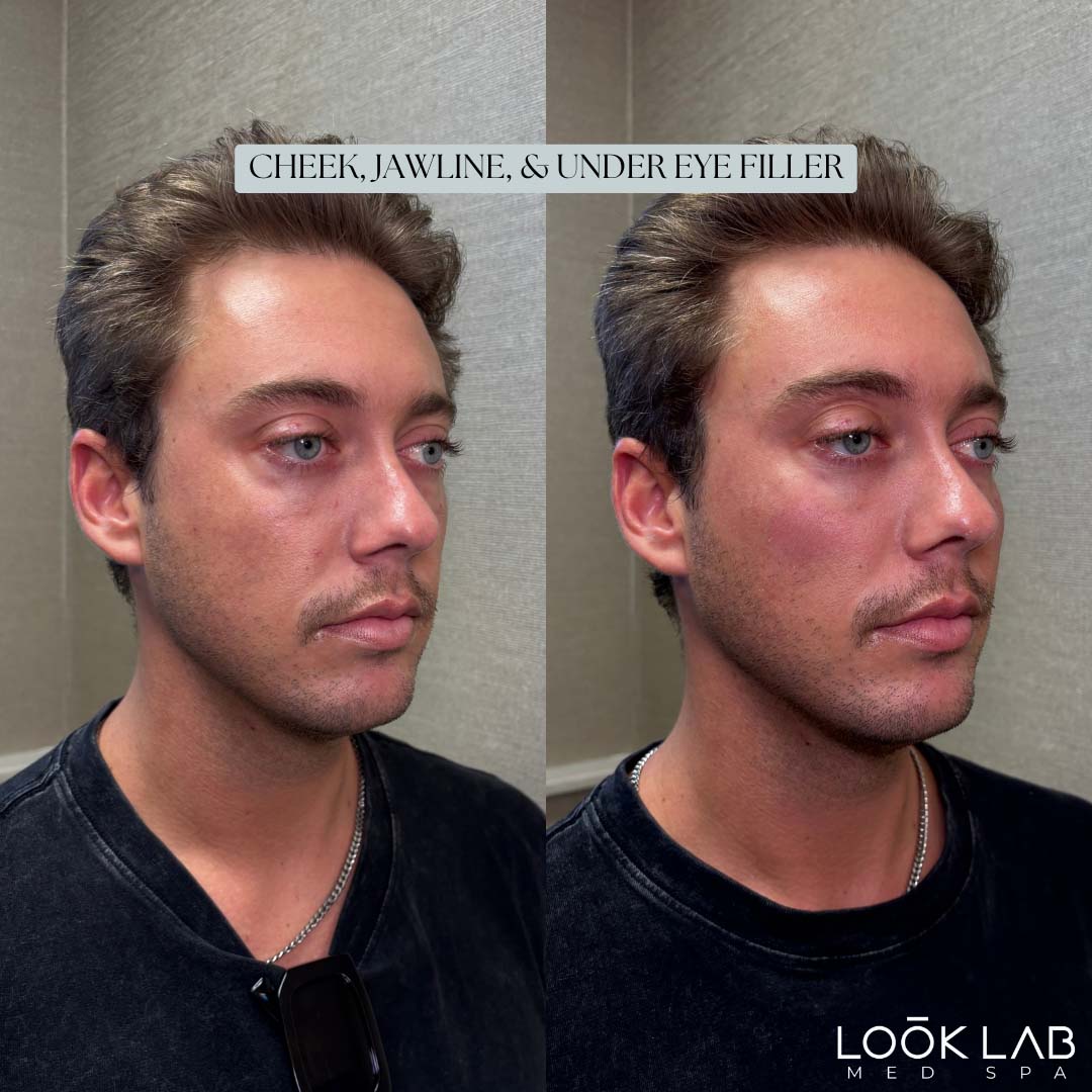 Before and After 43