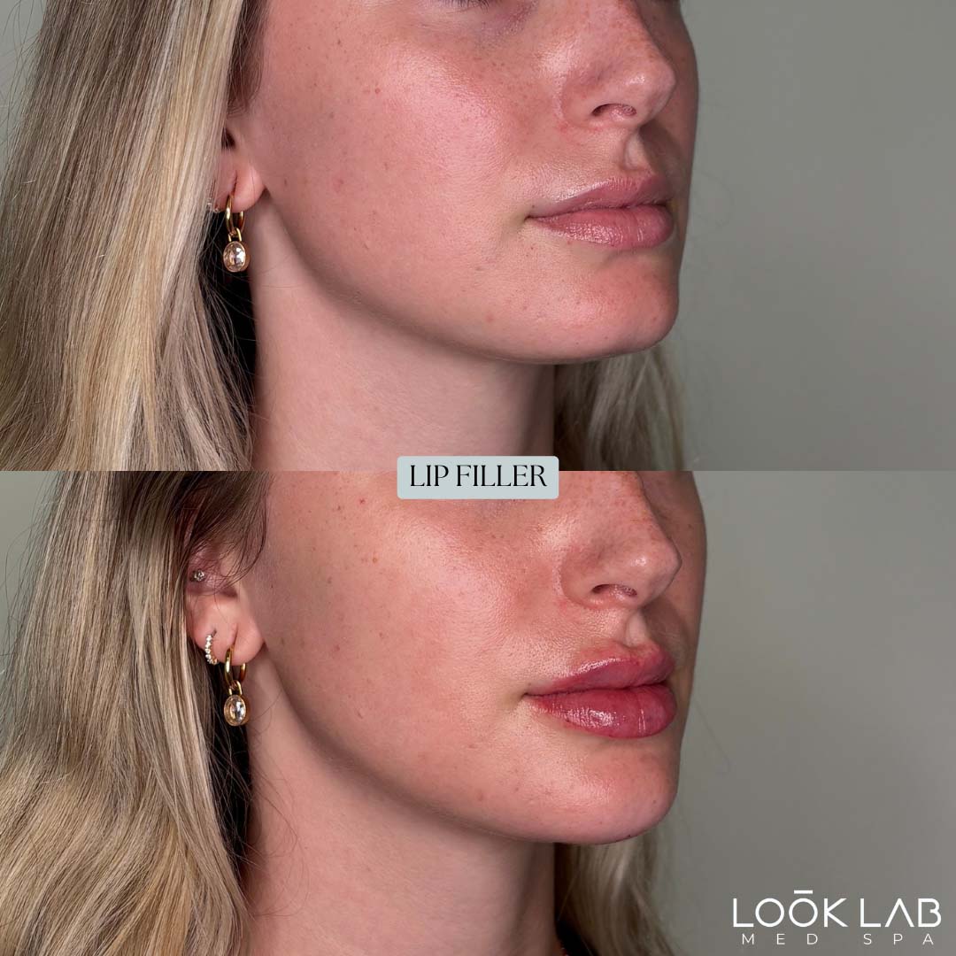 Before and After 46