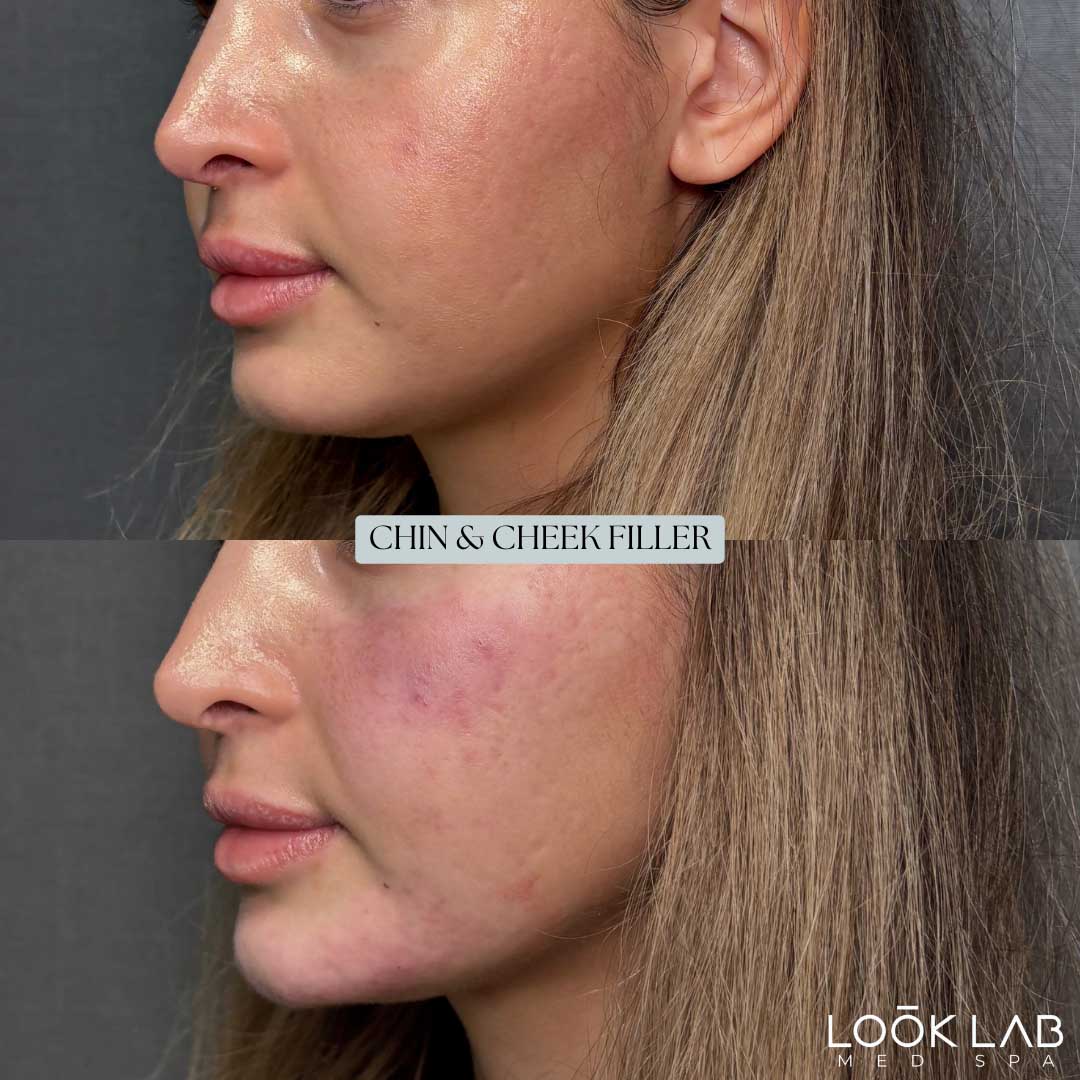Before and After 47