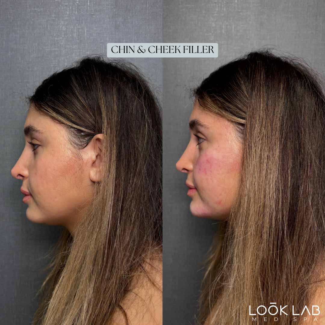 Before and After 48