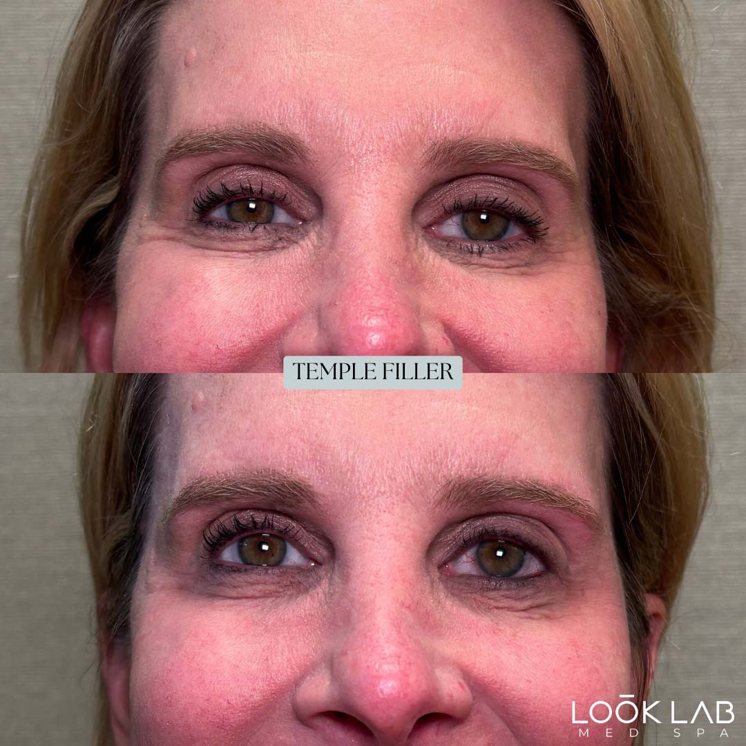 Before and After 42