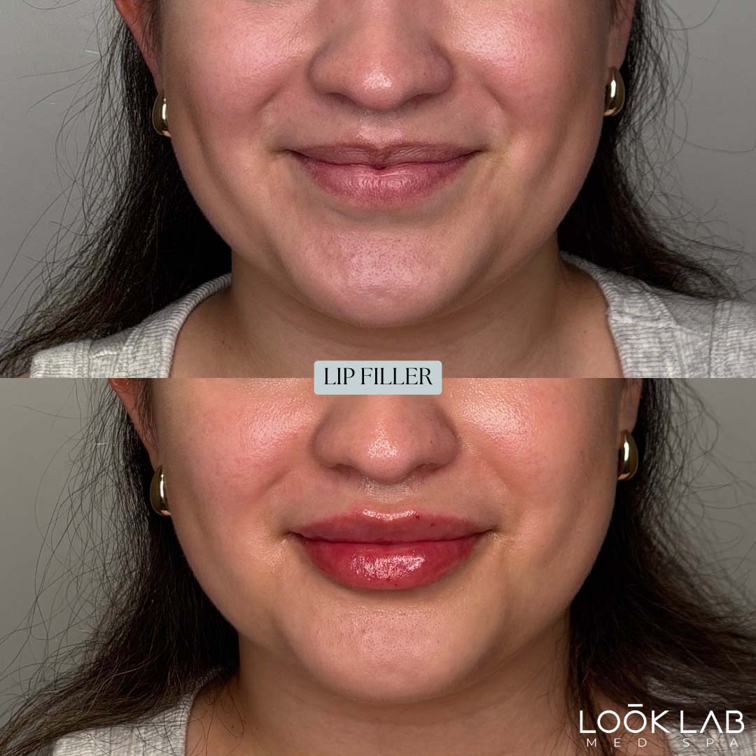Before and After 36