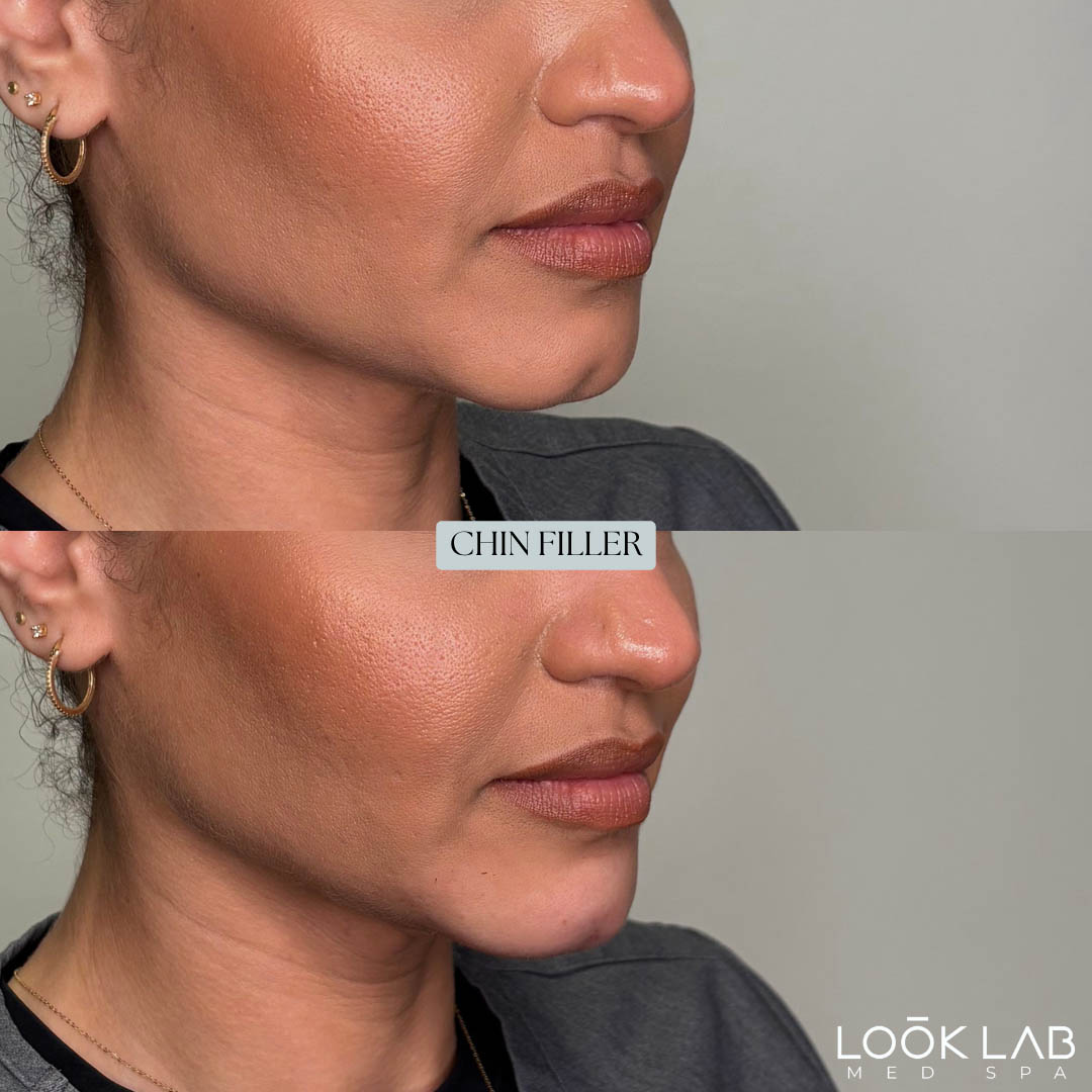 Before and After 37