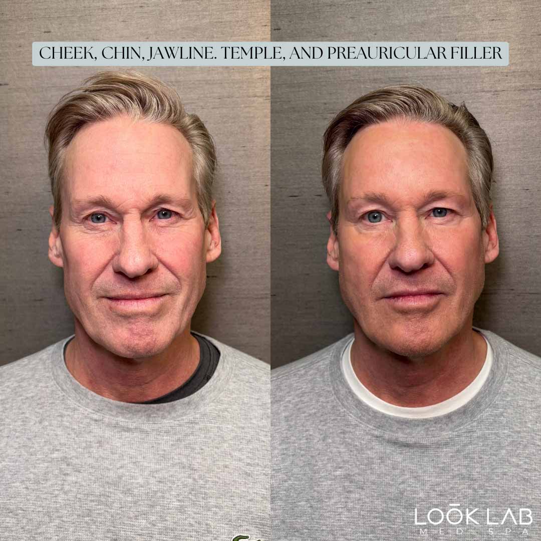 Before and After 38