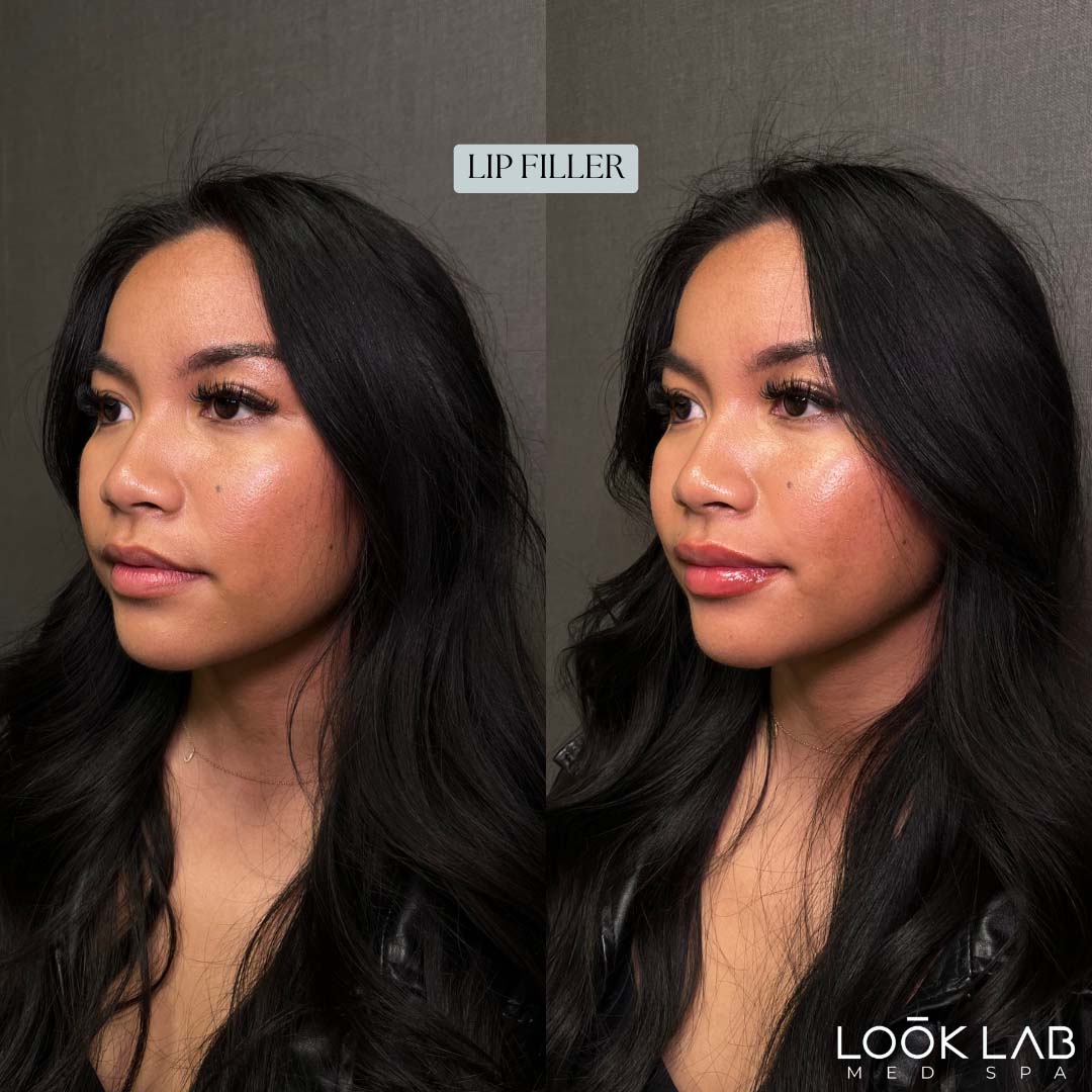 Before and After 39