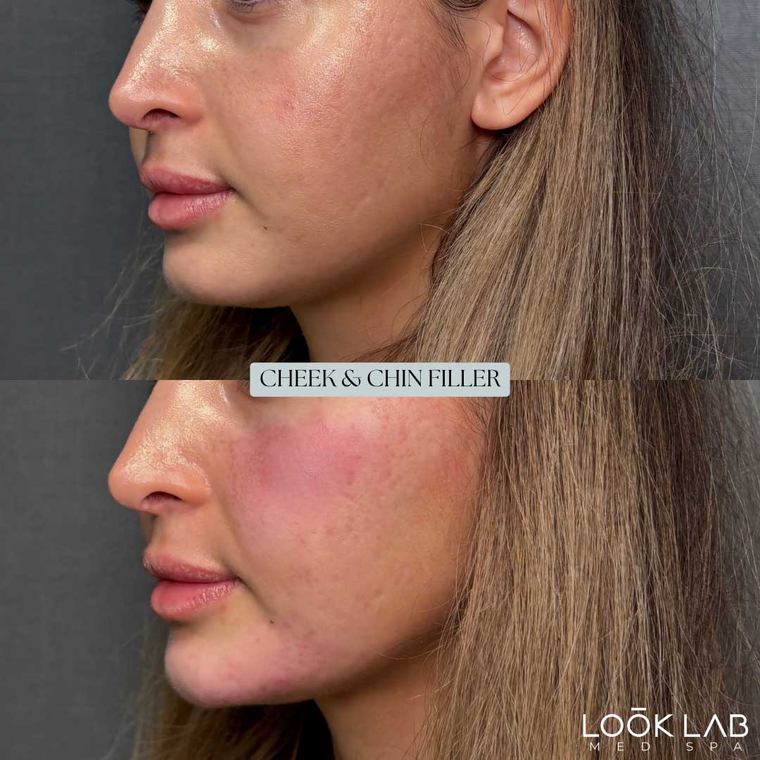 Before and After 40