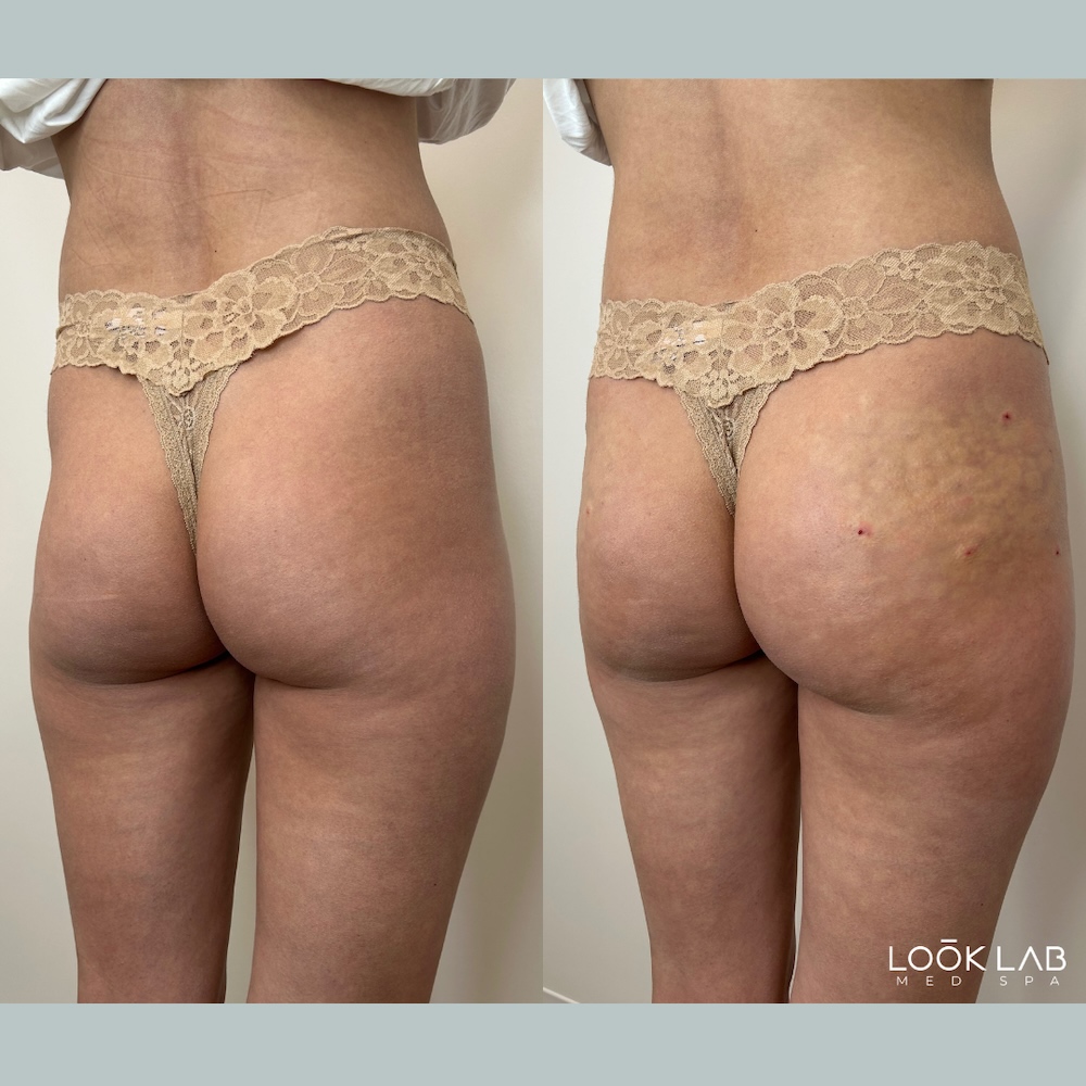 Before and After 2