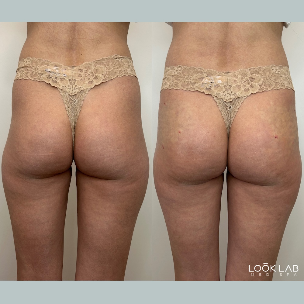Before and After 3