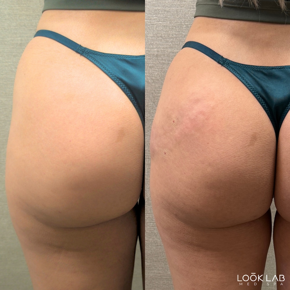 Before and After 4