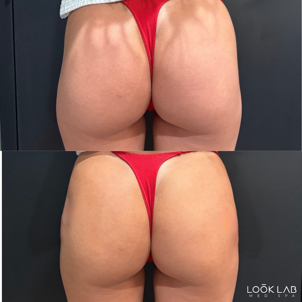Before and After 5