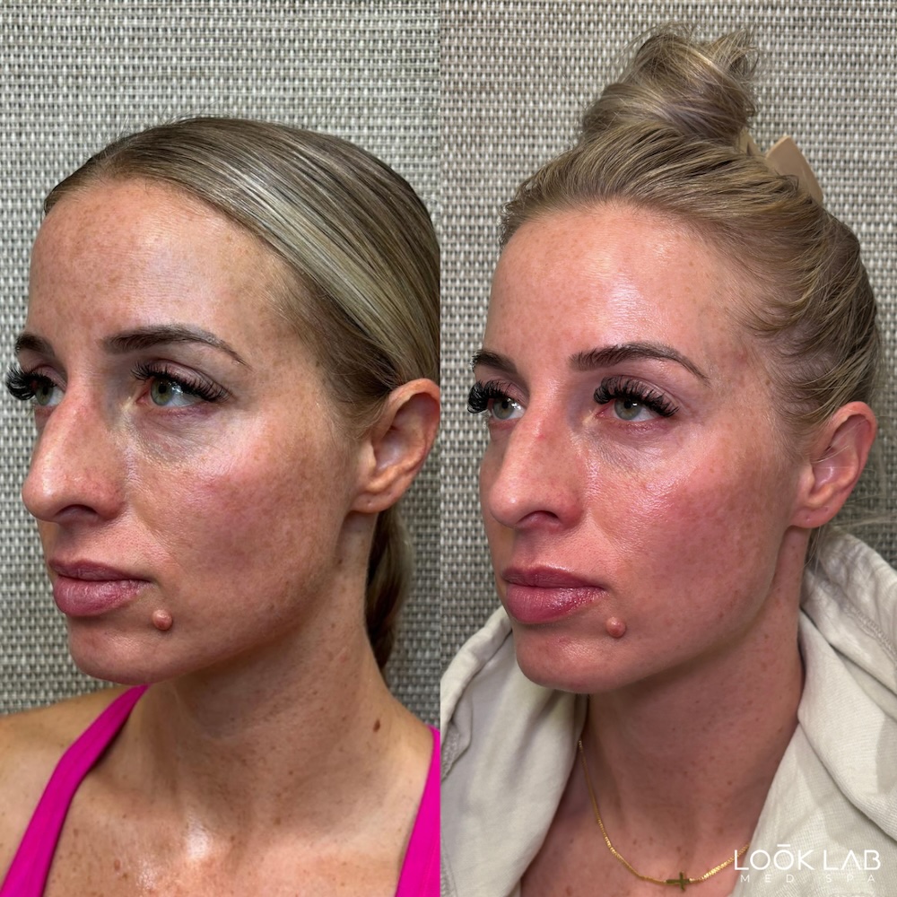 Before and After 2