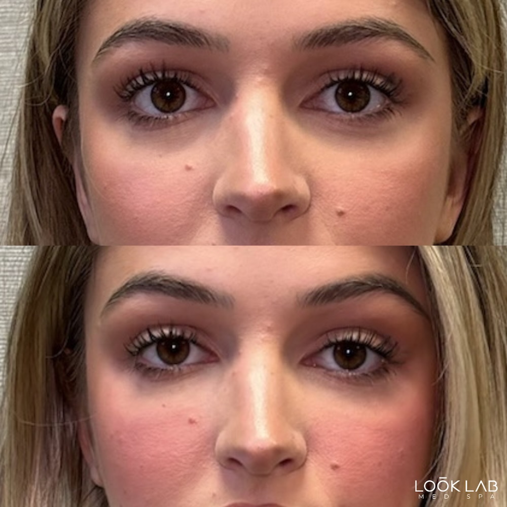 Before and After 3
