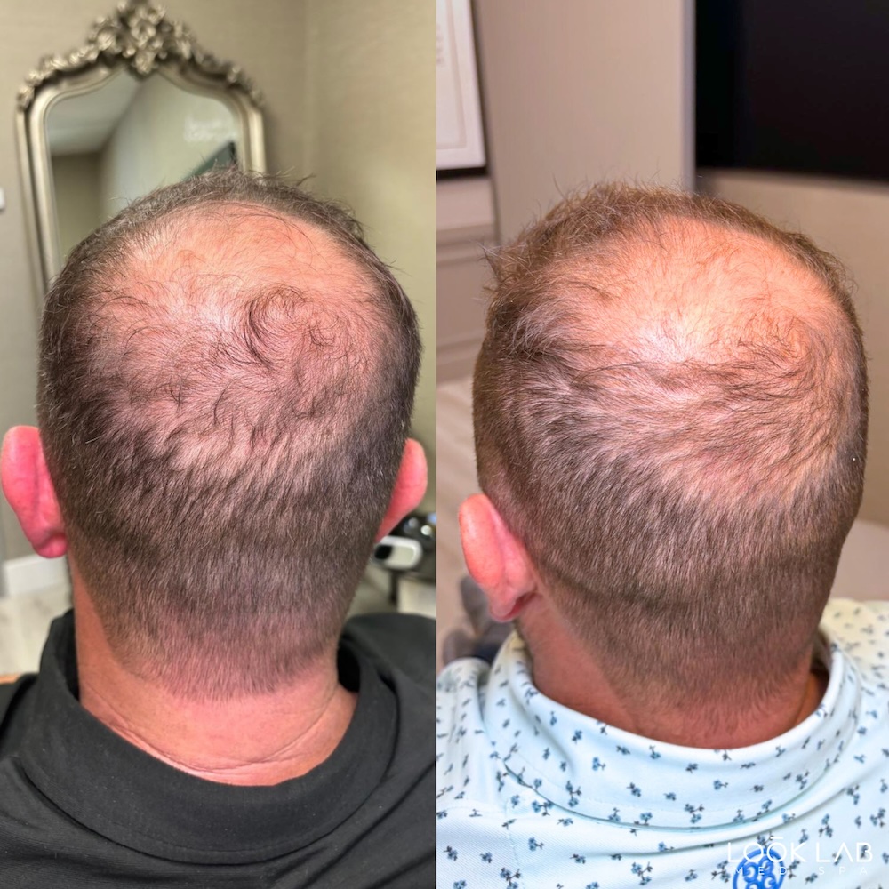 Before and After 4