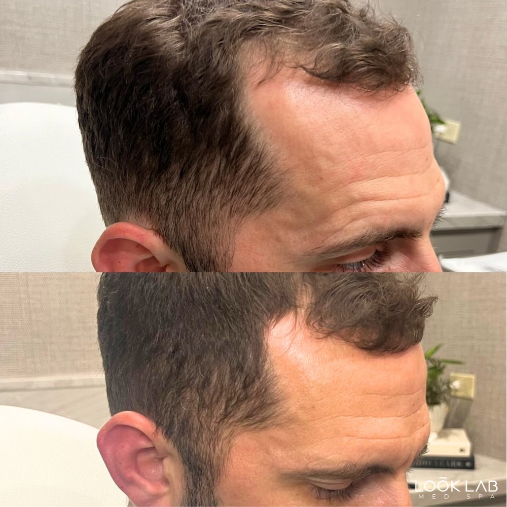 Before and After 5