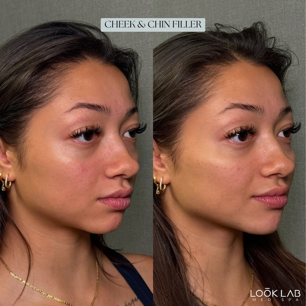 Before and After 27