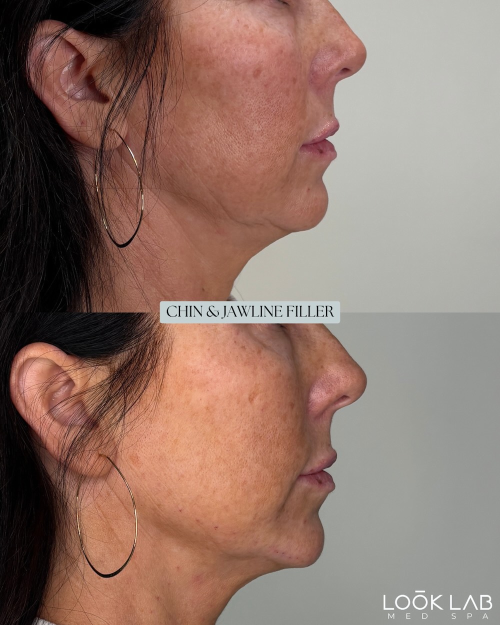 Before and After 26