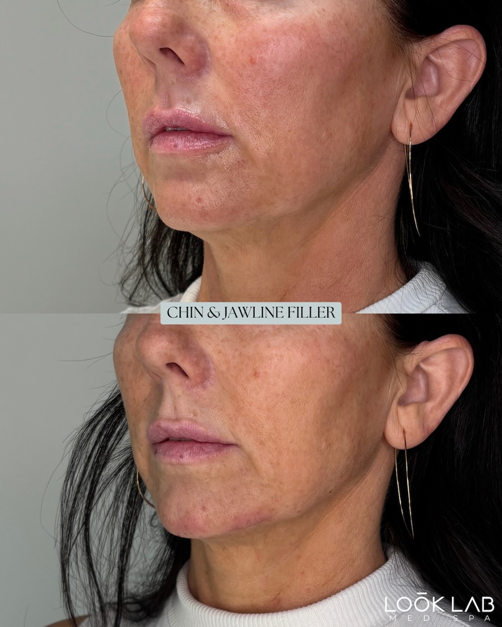 Before and After 24