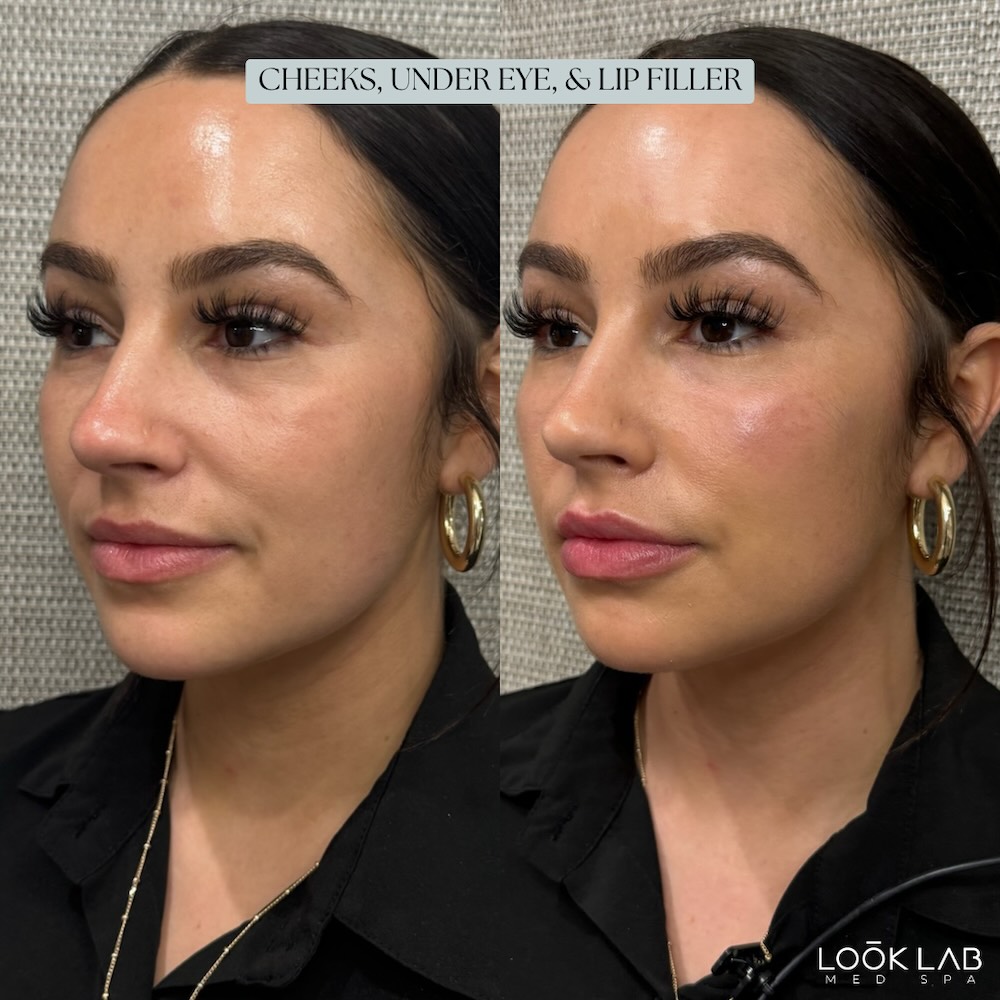 Before and After 28