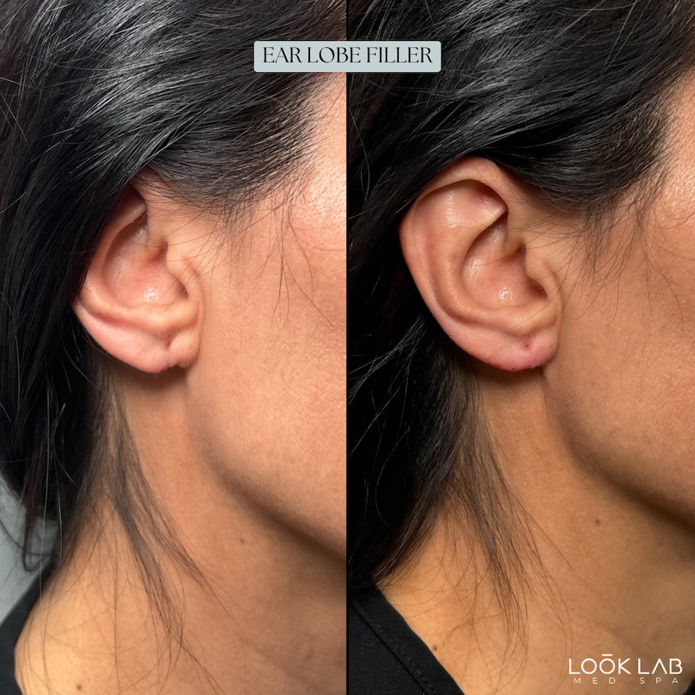Before and After 23