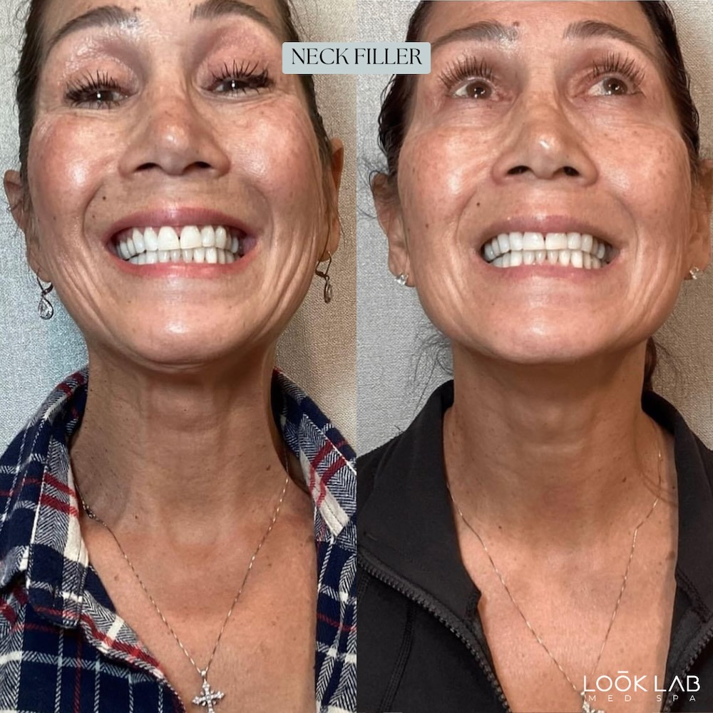 Before and After 21