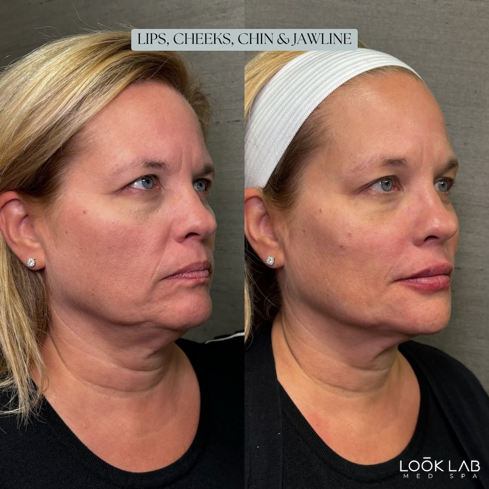 Before and After 20