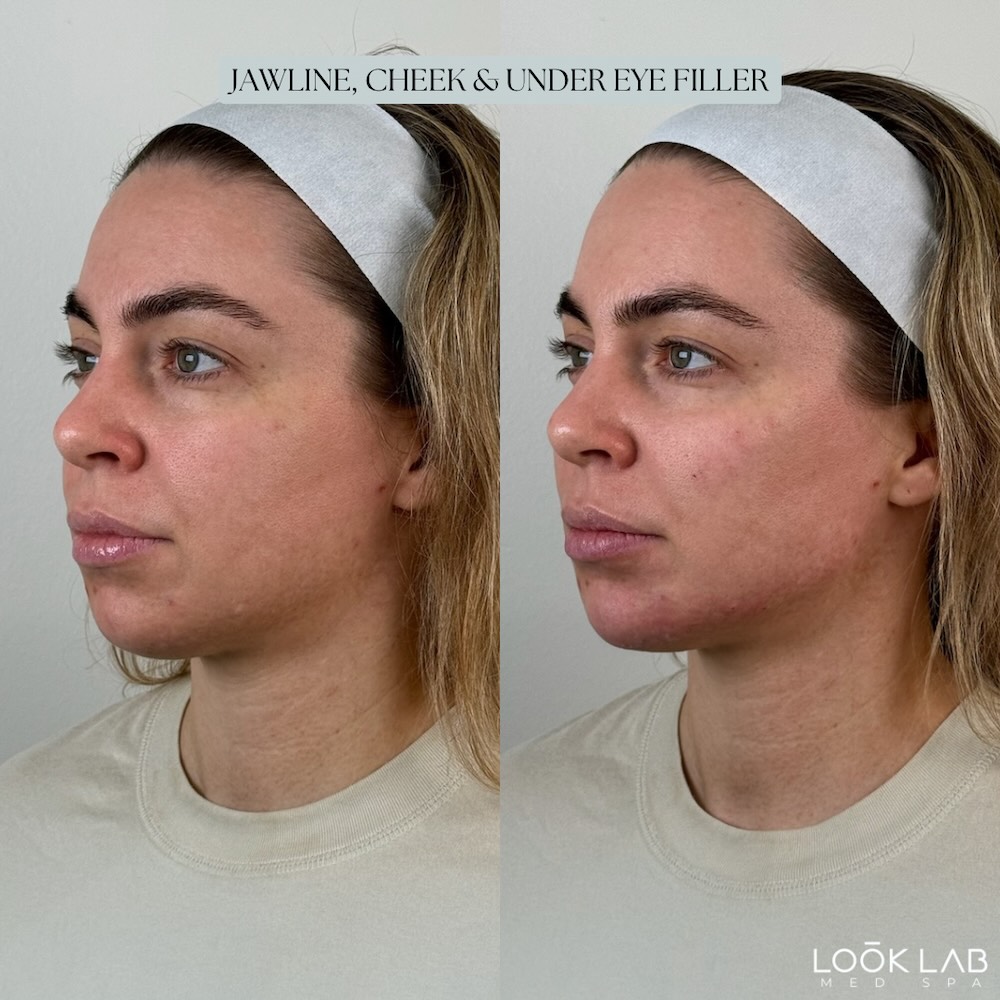 Before and After 22