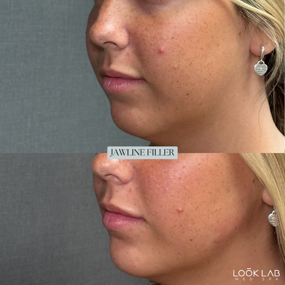 Before and After 18