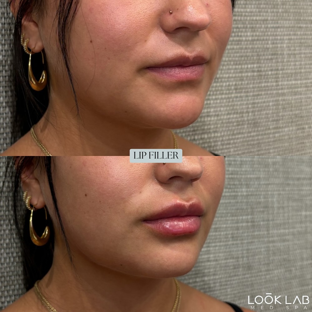 Before and After 13
