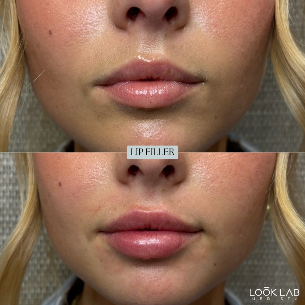 Before and After 17