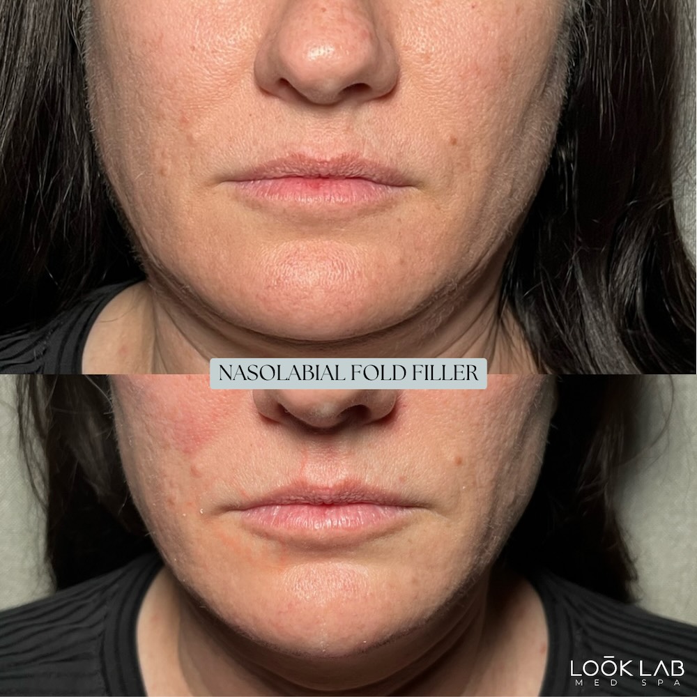 Before and After 12