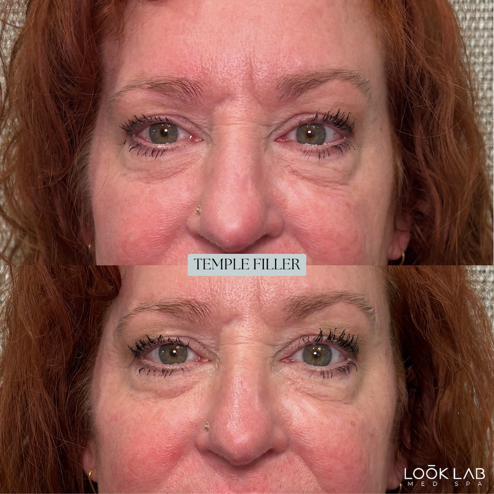 Before and After 11