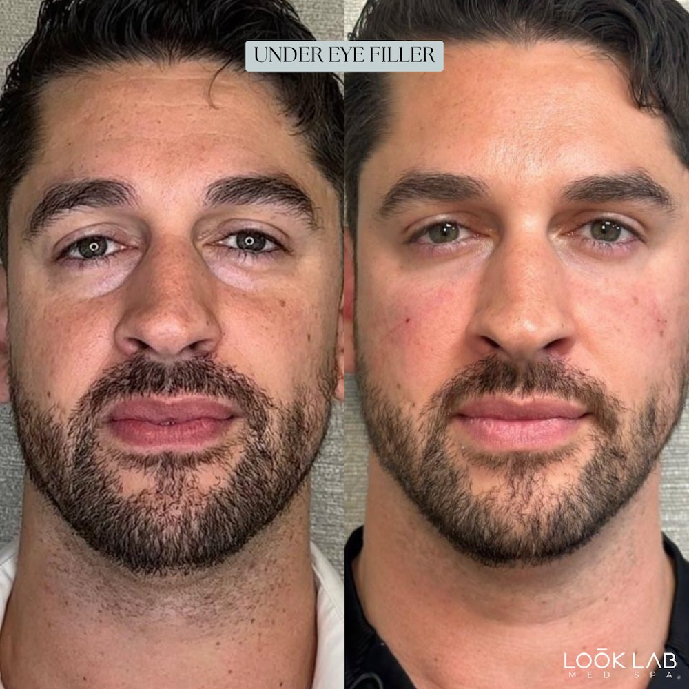 Before and After 7