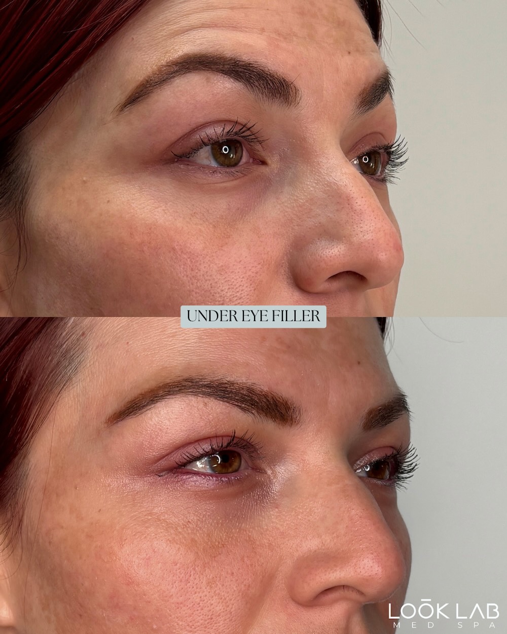 Before and After 9