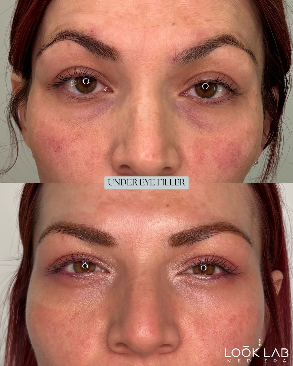 Before and After 8