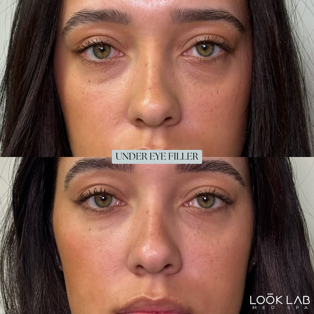 Before and After 6