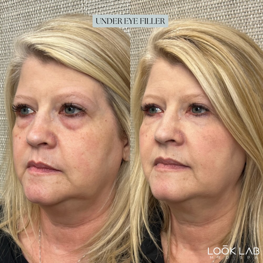 Before and After 5