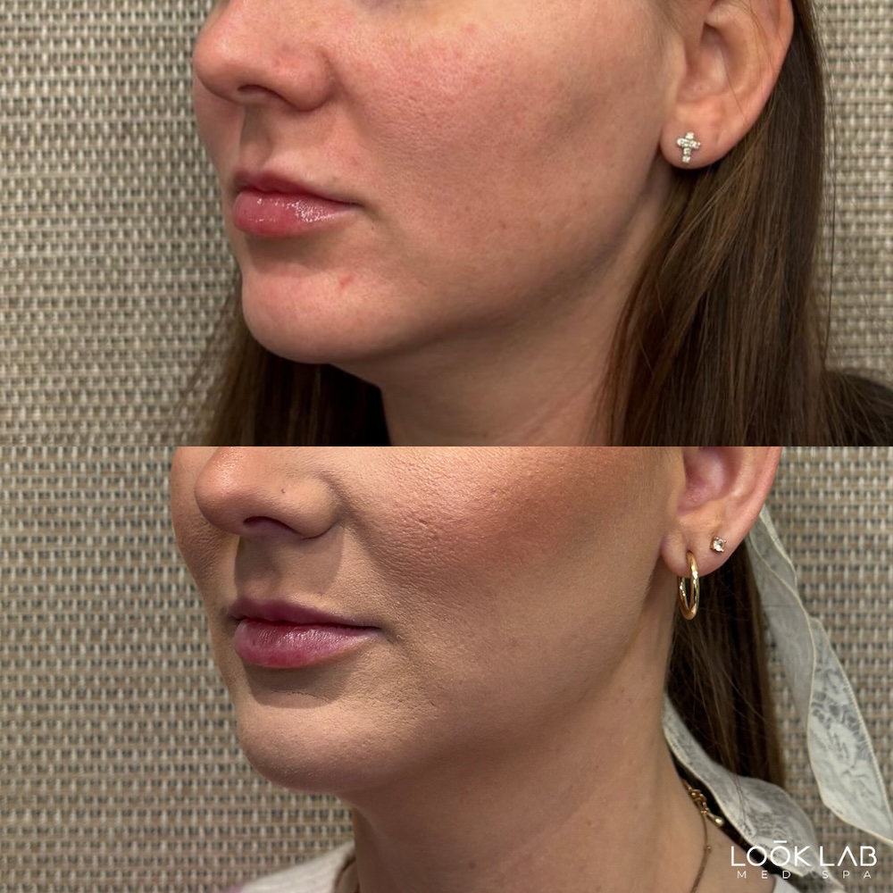 Before and After 3