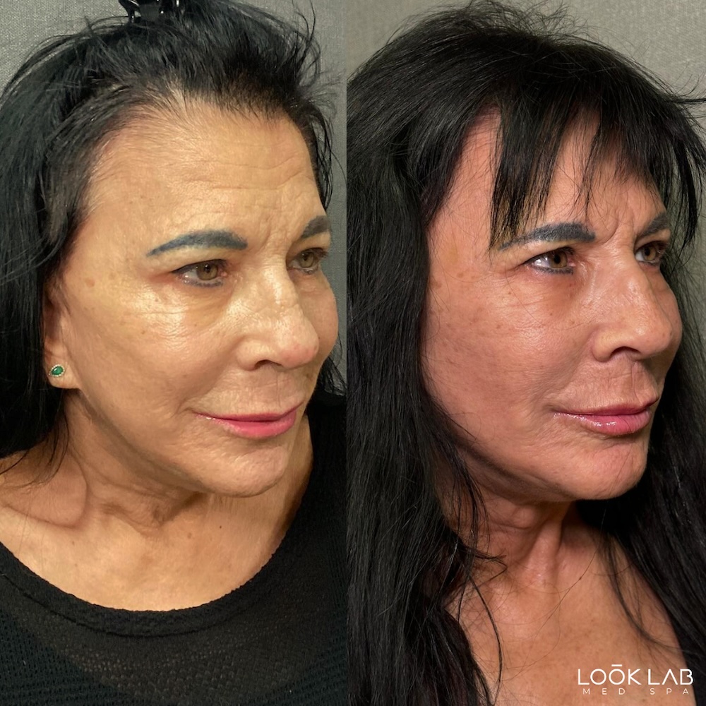 Before and After 5