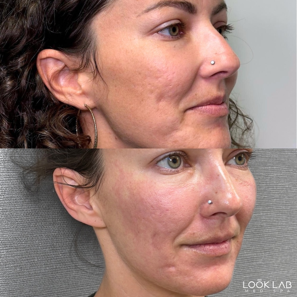Before and After 1