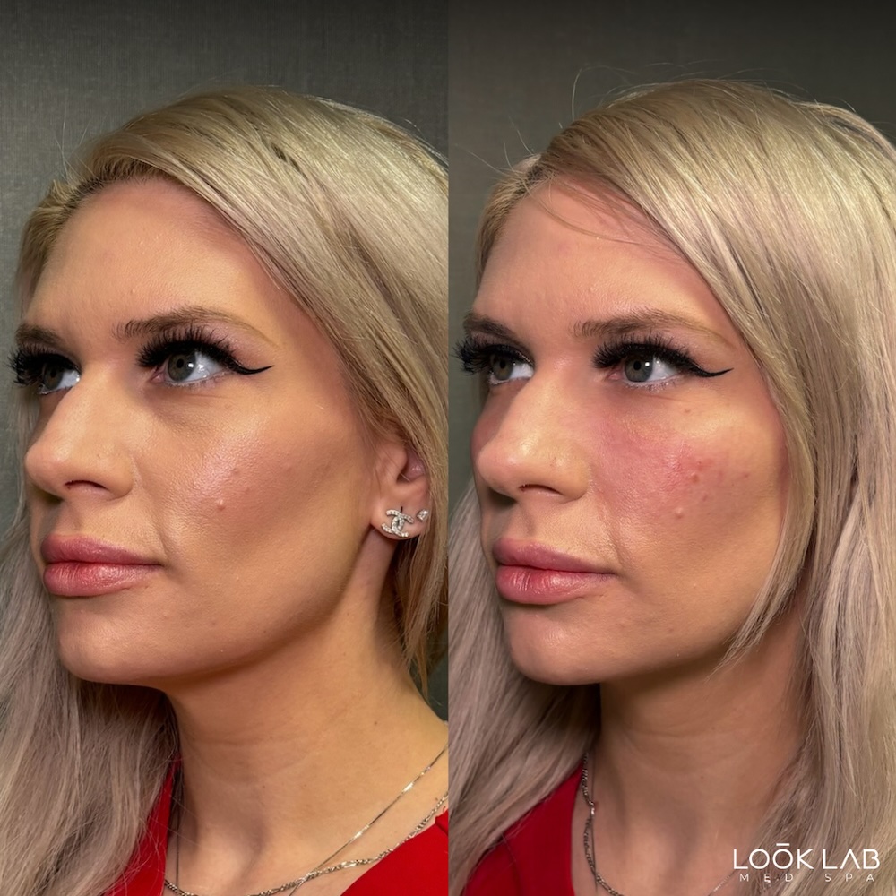 Before and After 2
