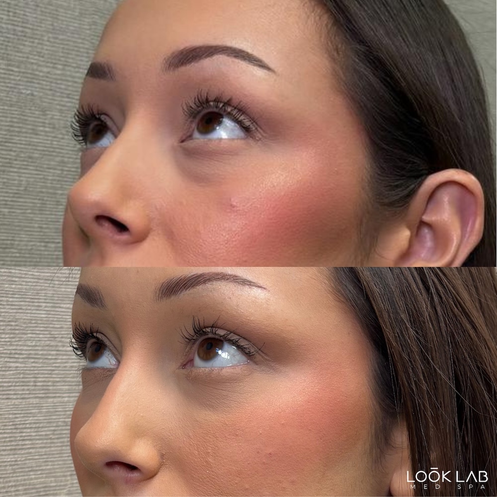 Before and After 4