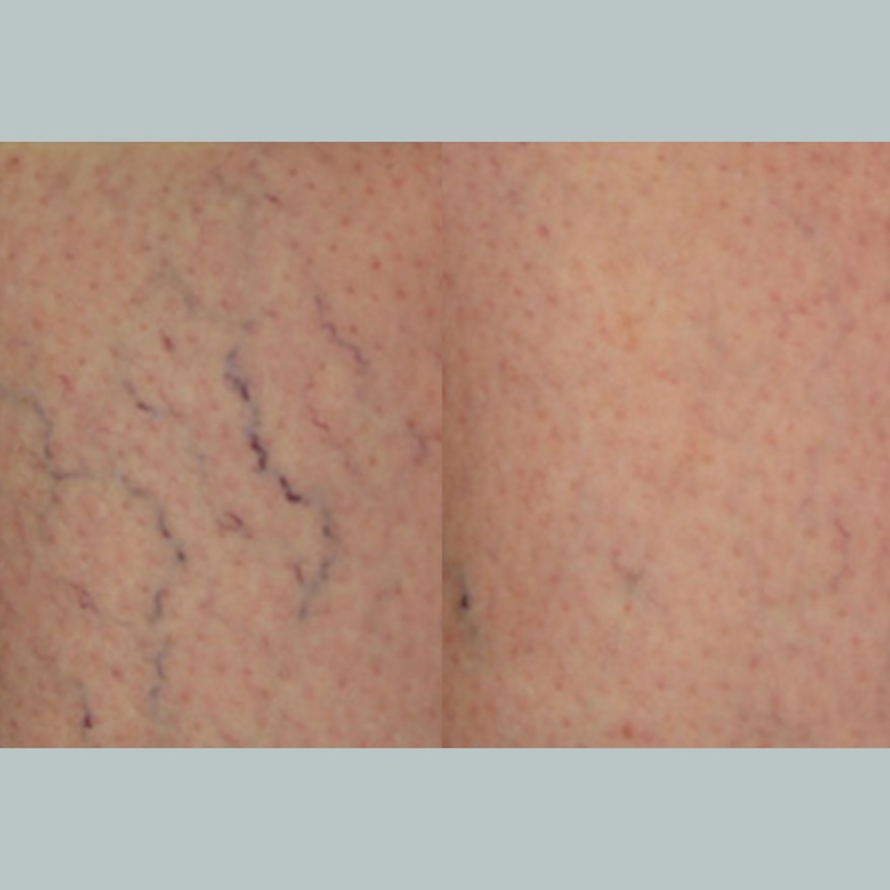 Before and After 2
