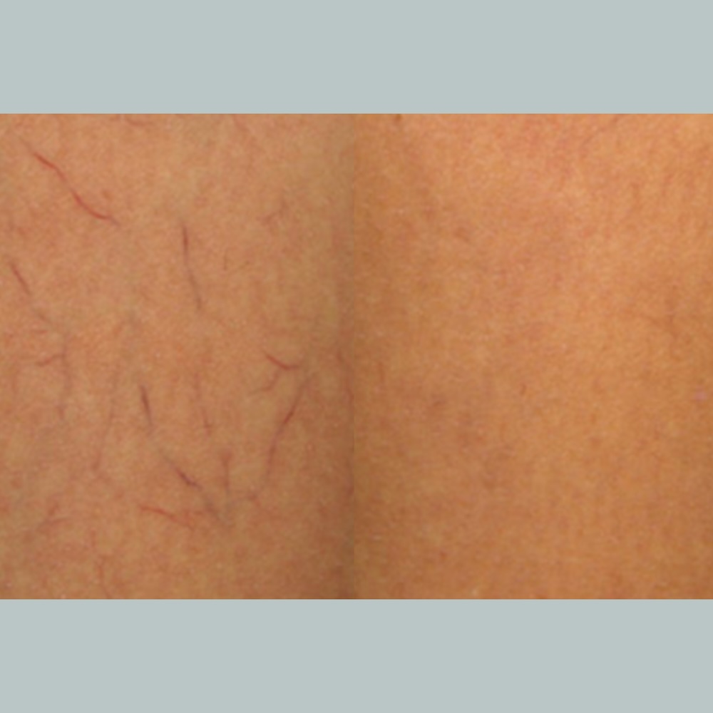 Before and After 3
