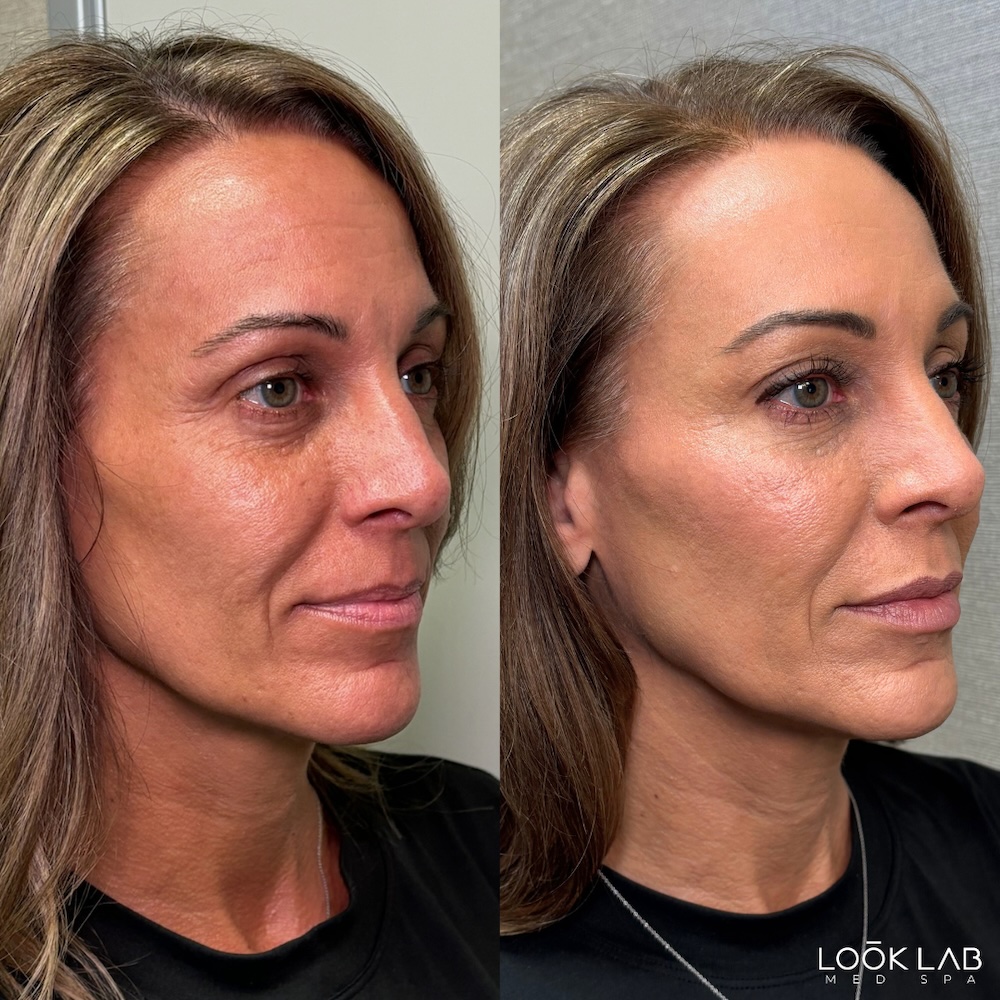 Before and After 3