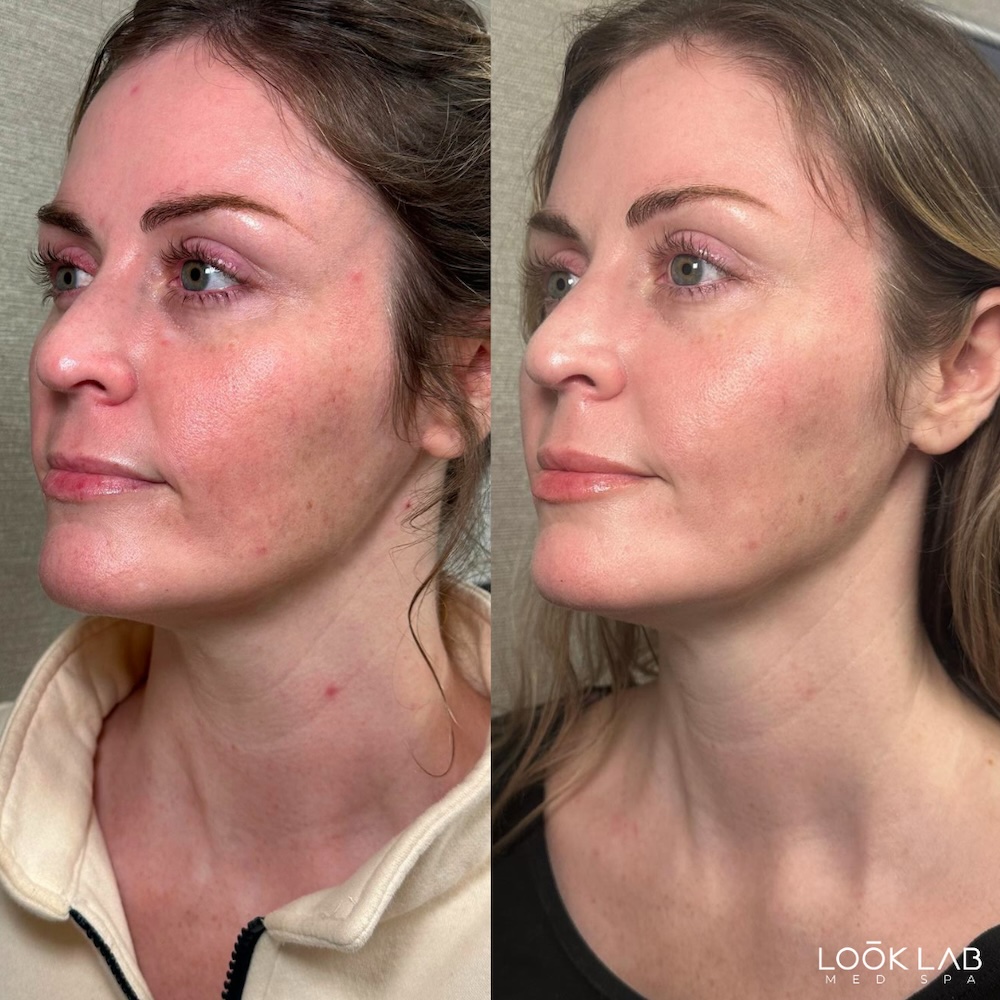 Before and After 1